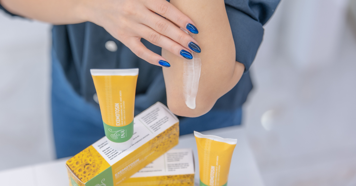 How to nourish the skin with Psoriasis? Try this Natural herbal cream