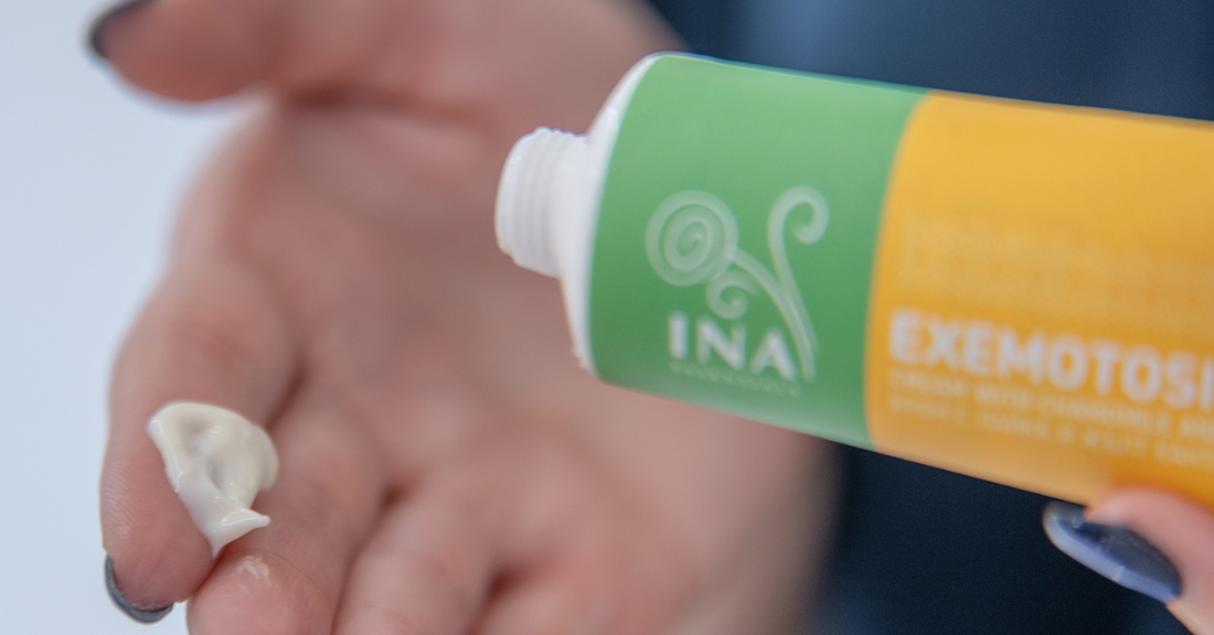 Eczema on Hands: Causes, Symptoms and Natural Care | InaEssentials