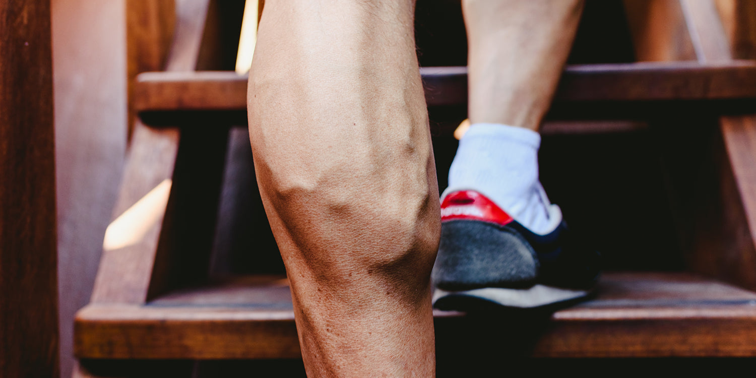 Varicose veins and fitness