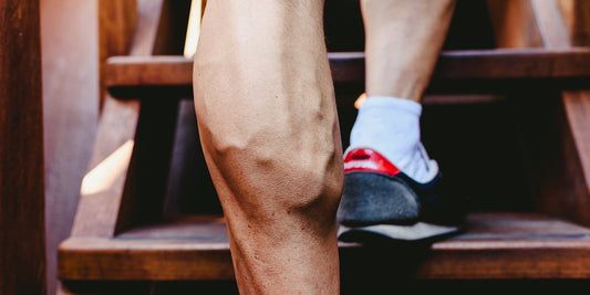 Varicose veins and fitness
