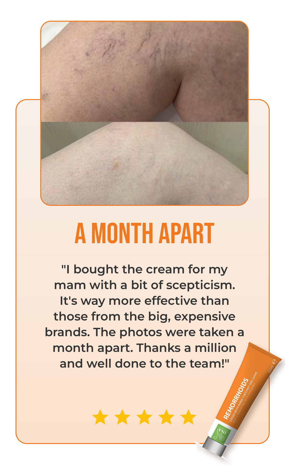 Remorrhoids review
