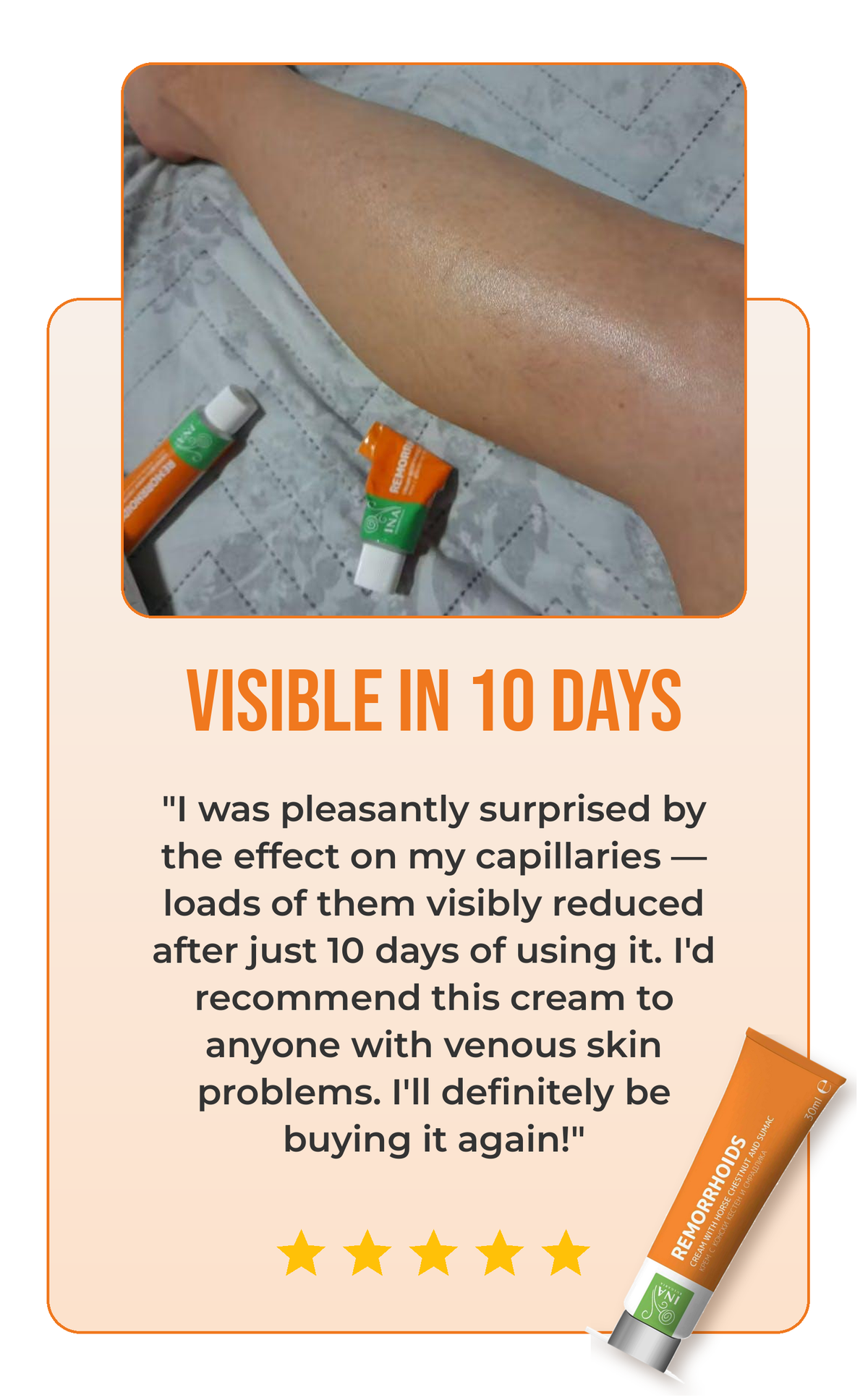 Remorrhoids review